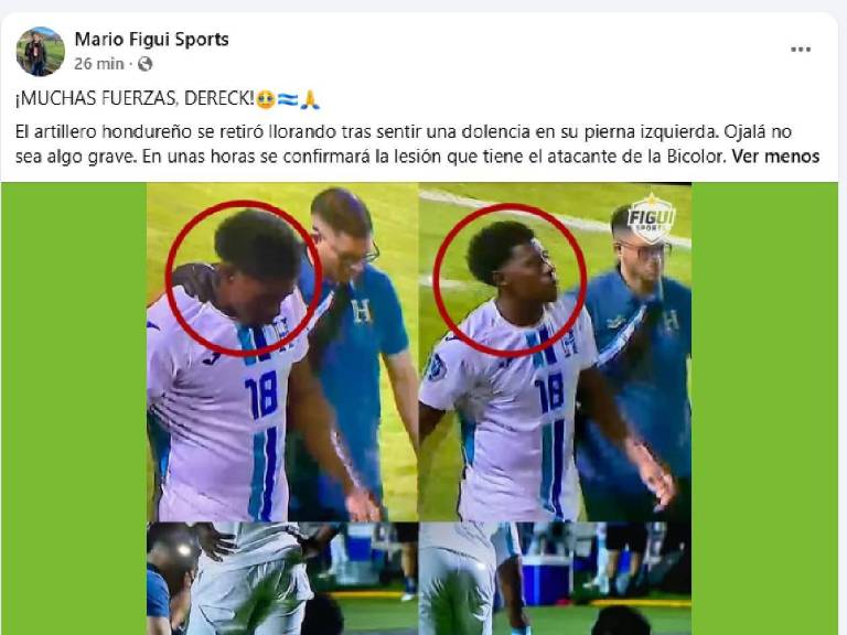 Cansaço, apontam dois e uma preocupação após a dolorosa derrota de Honduras contra Suriname.