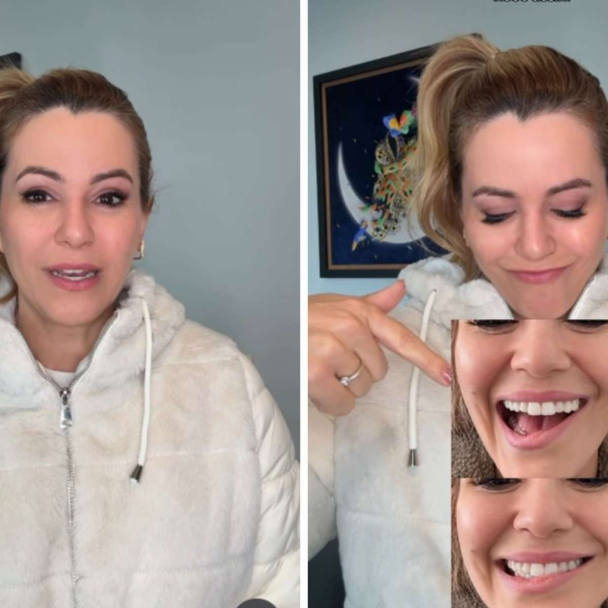 Ex-Panicat Tania Oliveira revela intercorrência em retirada de tumor: 'Meu sorriso ficou comprometido'