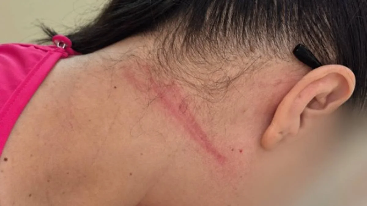 Fotos: técnica de enfermagem enforcada em UPA teve hematomas no pescoço