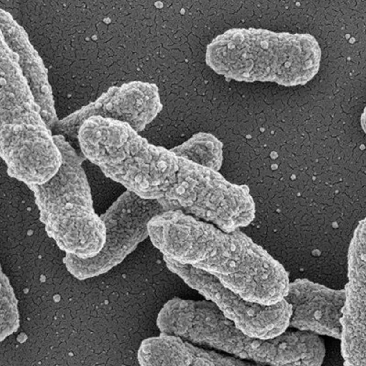 O que se sabe sobre a suspeita de peste pneumônica na Rússia