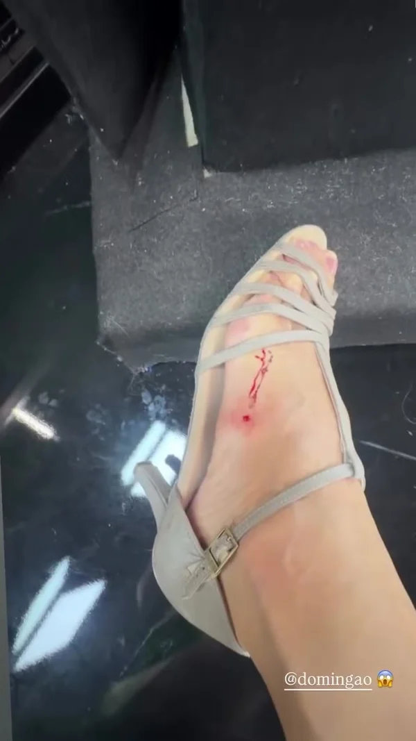 Ticiane Pinheiro mostra ferimentos após ensaios da Dança dos Famosos. Veja