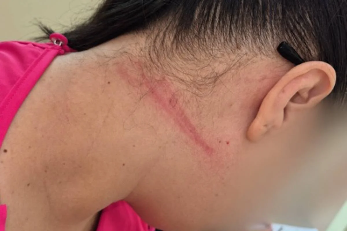 Fotos: técnica de enfermagem enforcada em UPA teve hematomas no pescoço
